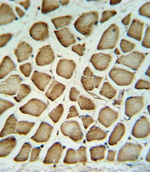 Polyclonal Rabbit anti-Human FGG / Fibrinogen Gamma Antibody (aa420-449, IHC, IF, WB)