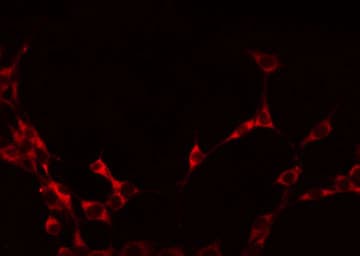 SYNCAM / CADM1 Antibody