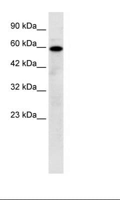 MCOLN1 / Mucolipin 1 Antibody (aa101-150, HRP)