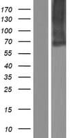 SLC34A3 / NaPi-2c Protein (Over-Expression Lysate Myc-DDK (Flag))