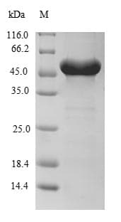 Mouse RPLP0 Protein (Recombinant 10His-SUMO, N-terminus + Myc, C-terminus)