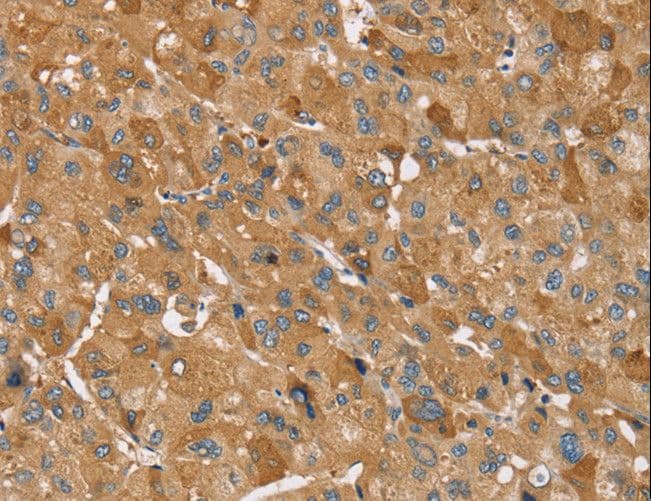 TRIM34 / RNF21 Antibody