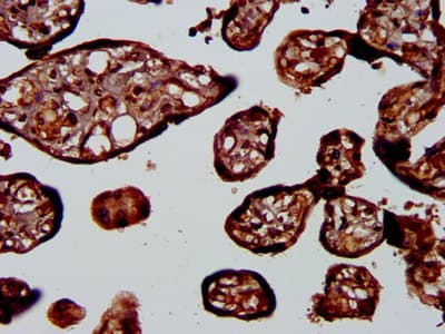 PSPLA1 / Phospholipase A1 Antibody