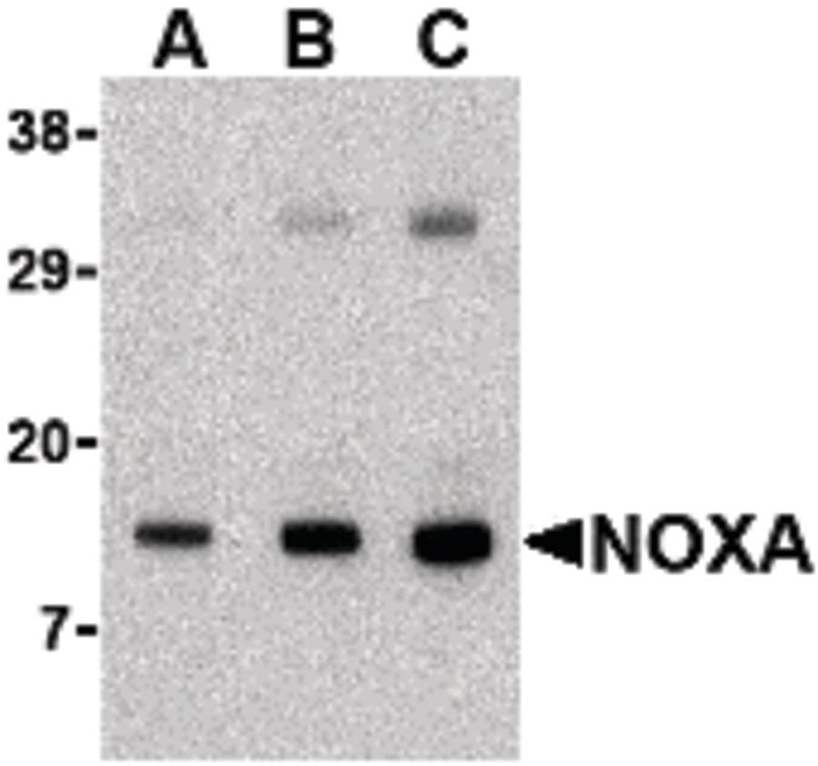 IHC-plus™ PMAIP1 / NOXA Antibody