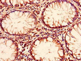 Polyclonal Rabbit anti-Human ENTPD8 Antibody