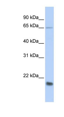 EMA / MUC1 Antibody (aa36-85)