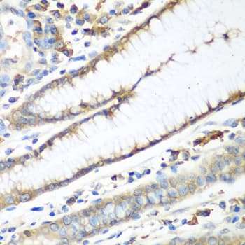 Polyclonal Rabbit anti-Human CAD Antibody (IHC, WB)