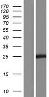 C11orf88 Protein (Over-Expression Lysate Myc-DDK (Flag))