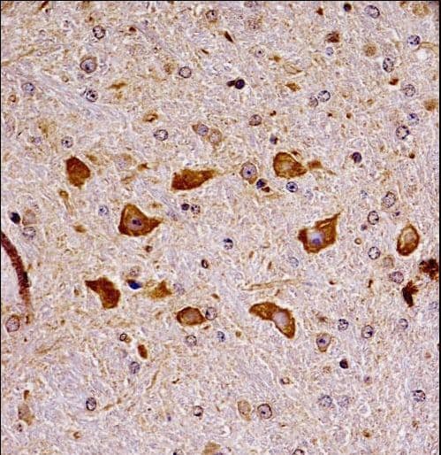 PAK7/PAK5 Antibody (aa128-157)