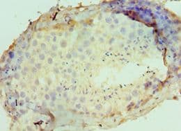 Dipeptidylpeptidase 8 / DPP8 Antibody (aa10-230)