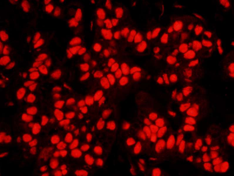 NPM1 / NPM / Nucleophosmin Antibody (aa250-294)
