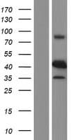 Human RRM2B / P53R2 Protein (Over-Expression Lysate Myc-DDK (Flag))