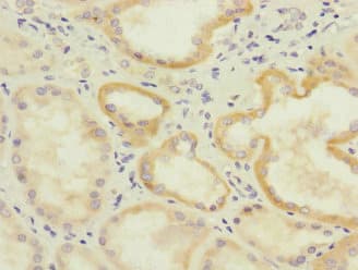 Polyclonal Rabbit anti-Human IL17RB Antibody (IHC)