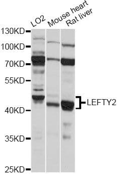 TGFB4 / LEFTY2 Antibody