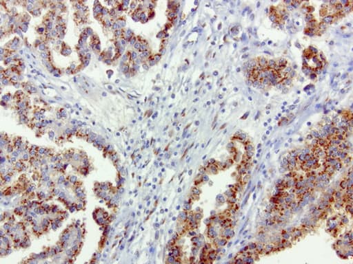 Monoclonal Mouse anti-Human SQSTM1 Antibody (clone UMAB12, Carrier-free, IHC, IF, WB)