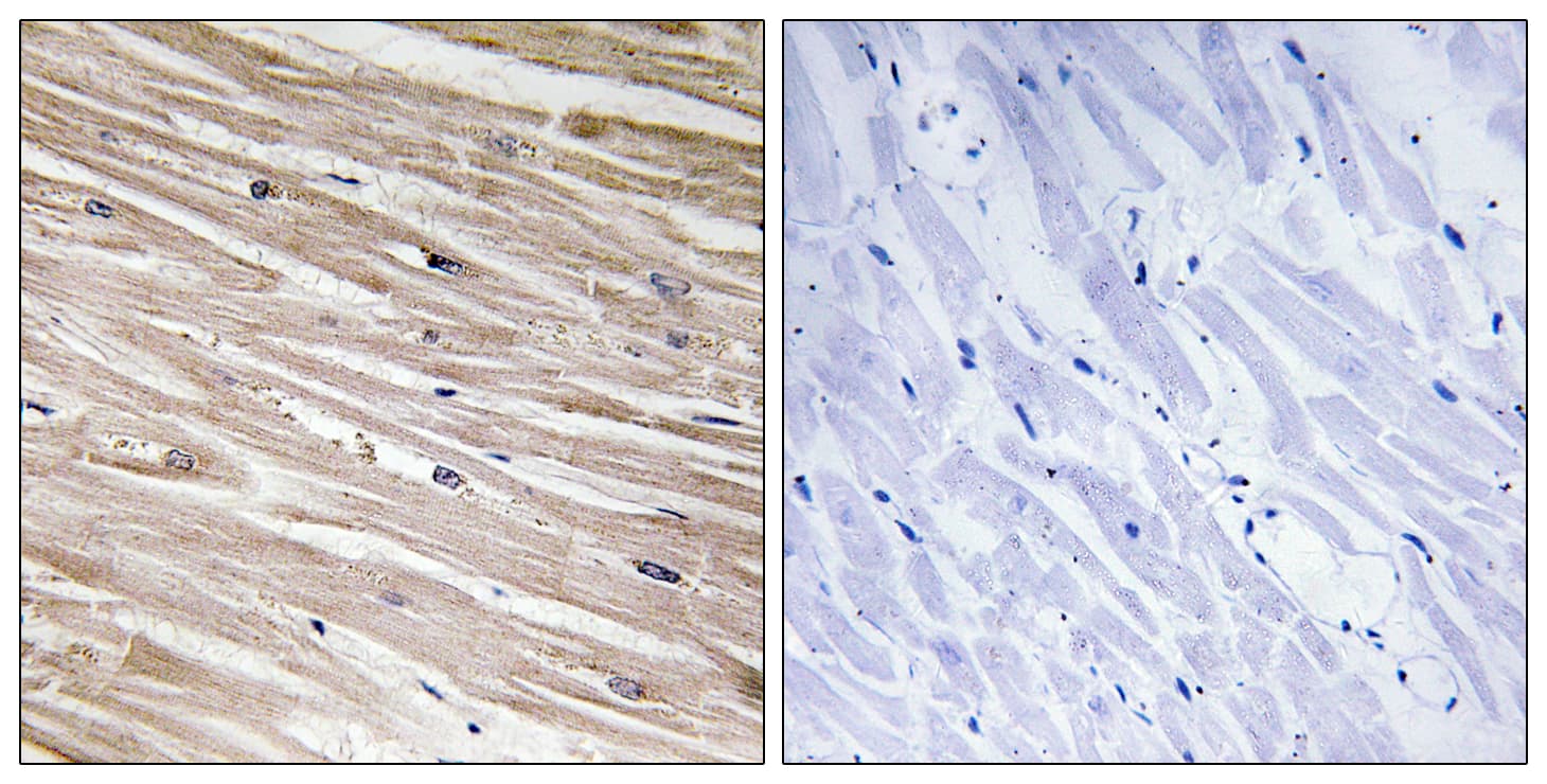 PEA15 / PEA-15 Antibody (phospho-Ser104)