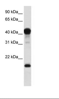 TEAD1 Antibody (C-Terminus)