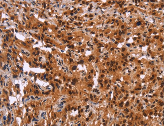 ADGRA2 / GPR124 Antibody
