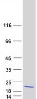 Human POLD4 Protein (Recombinant Myc-DDK (Flag))