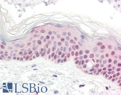 SLC6A2 / NET Antibody