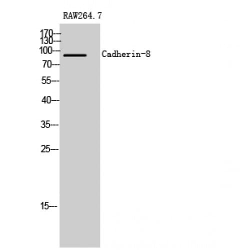 CDH8 / Cadherin 8 Antibody (460-540 aa, Internal)