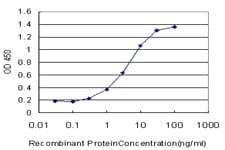 RLBP1 / CRALBP Antibody (clone 1H7)
