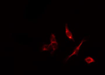 DAPK2 / DAP Kinase 2 Antibody