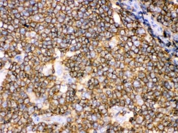 CD45 / LCA Antibody