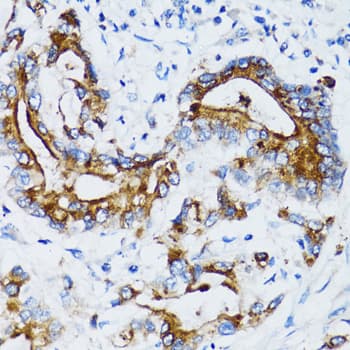 MMP7 / Matrilysin Antibody