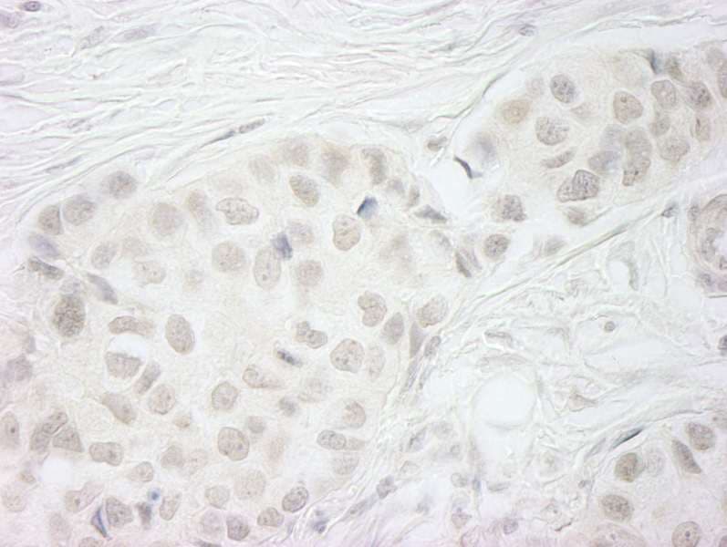 BUB1B / BubR1 Antibody (aa1-50)