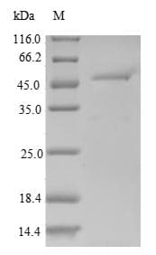 Human ARHGEF18 Protein (Recombinant 6His-SUMO, N-terminus)