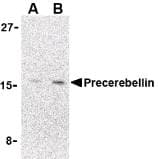 CBLN1 / Cerebellin 1 Antibody