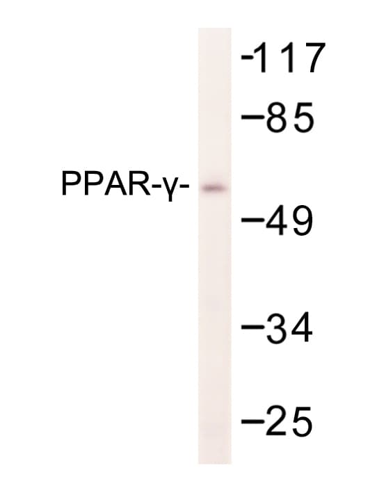 PPARG / PPAR Gamma Antibody (Ile106)