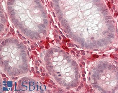 IHC-plus™ LRRC8A / LRRC8 Antibody