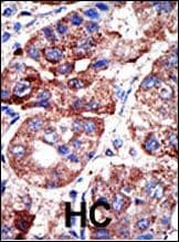 Polyclonal Rabbit anti-Human SQSTM1 Antibody (aa317-346, IHC, IF, WB)