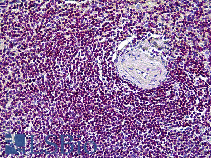 IHC-plus™ CDK6 Antibody (clone 8H4)