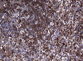 RASGRP3 / GRP3 Antibody (aa380-690, clone OTI2C11)