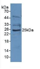 EBI3 / IL-27B Antibody (aa21-229)