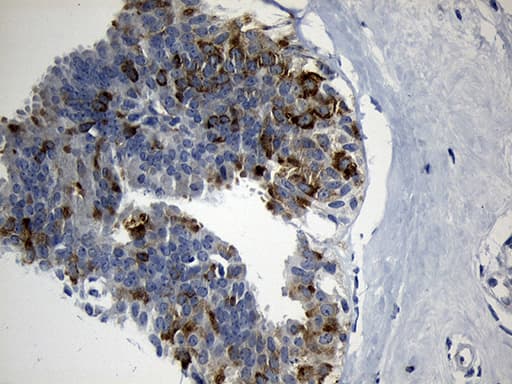 Monoclonal Mouse anti-Human FBXO6 Antibody (clone OTI7A10, Carrier-free, IHC, WB)