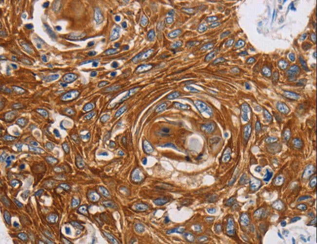 GRIN1 / NMDAR1 Antibody