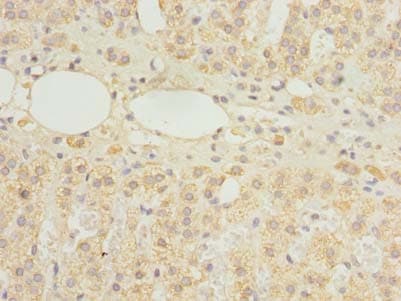 Polyclonal Rabbit anti-Human HDHD3 Antibody (IHC, WB)