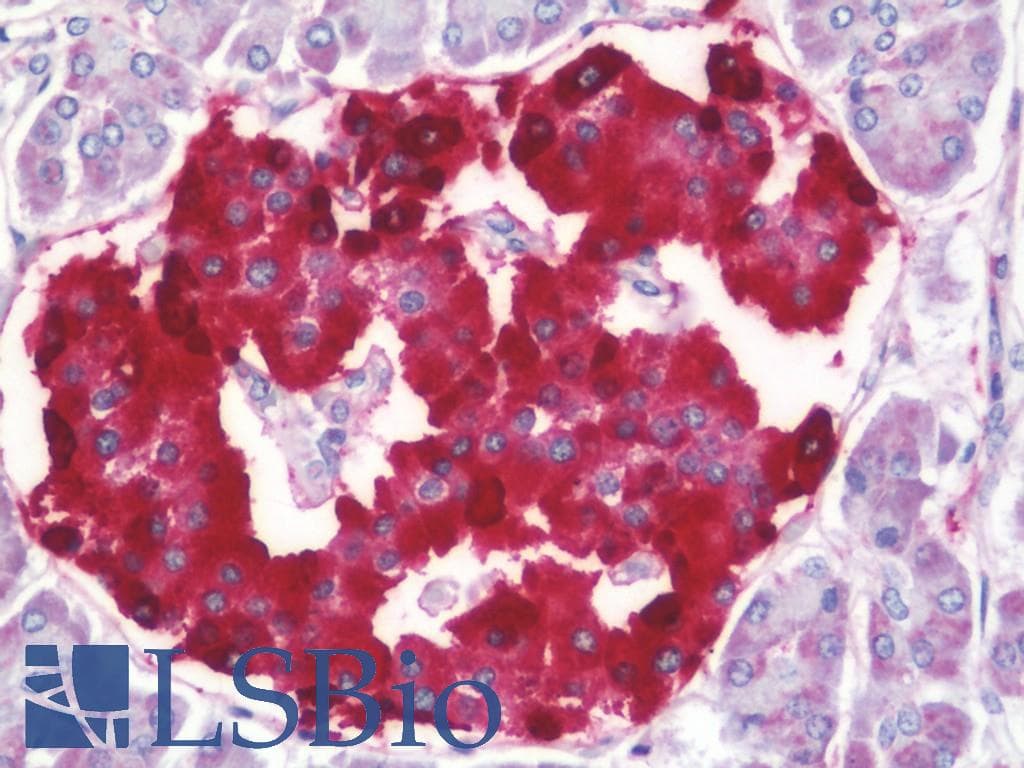 IHC-plus™ SCG2 / Secretogranin II Antibody
