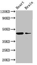 P2RX1 / P2X1 Antibody