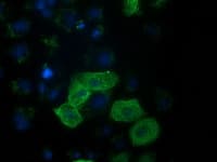 RASSF1 / RASSF1A Antibody (clone OTI8A11)
