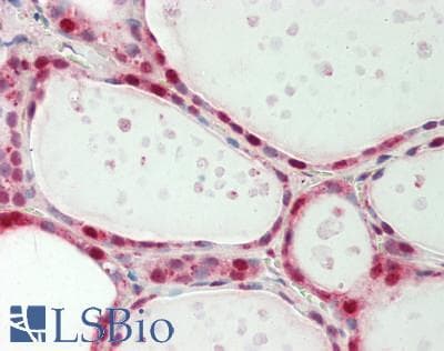 IHC-plus™ EIF4A3 Antibody (aa1-50)