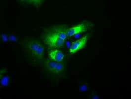 IHC-plus™ TF / Transferrin Antibody (clone 5G2)
