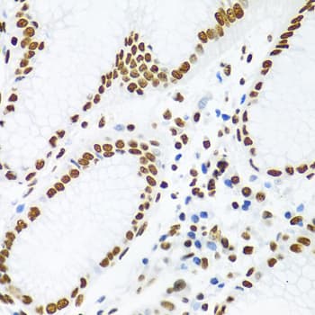 KHDRBS1 / SAM68 Antibody
