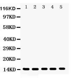 PFN1 / Profilin 1 Antibody (aa116-140)