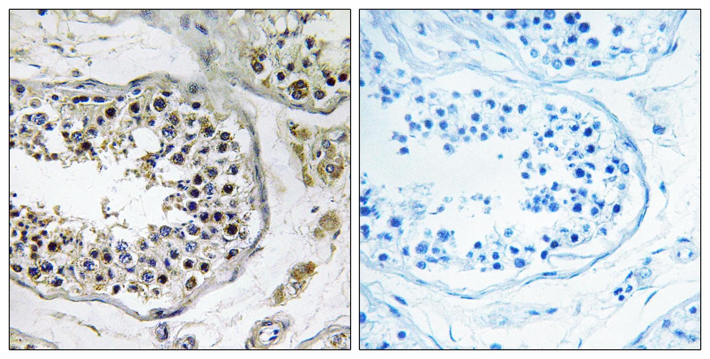 Polyclonal Rabbit anti-Human NBPF4 Antibody (IHC)