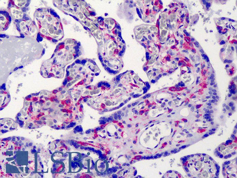 IHC-plus™ IKBKG / NEMO / IKK Gamma Antibody (clone 46B844)